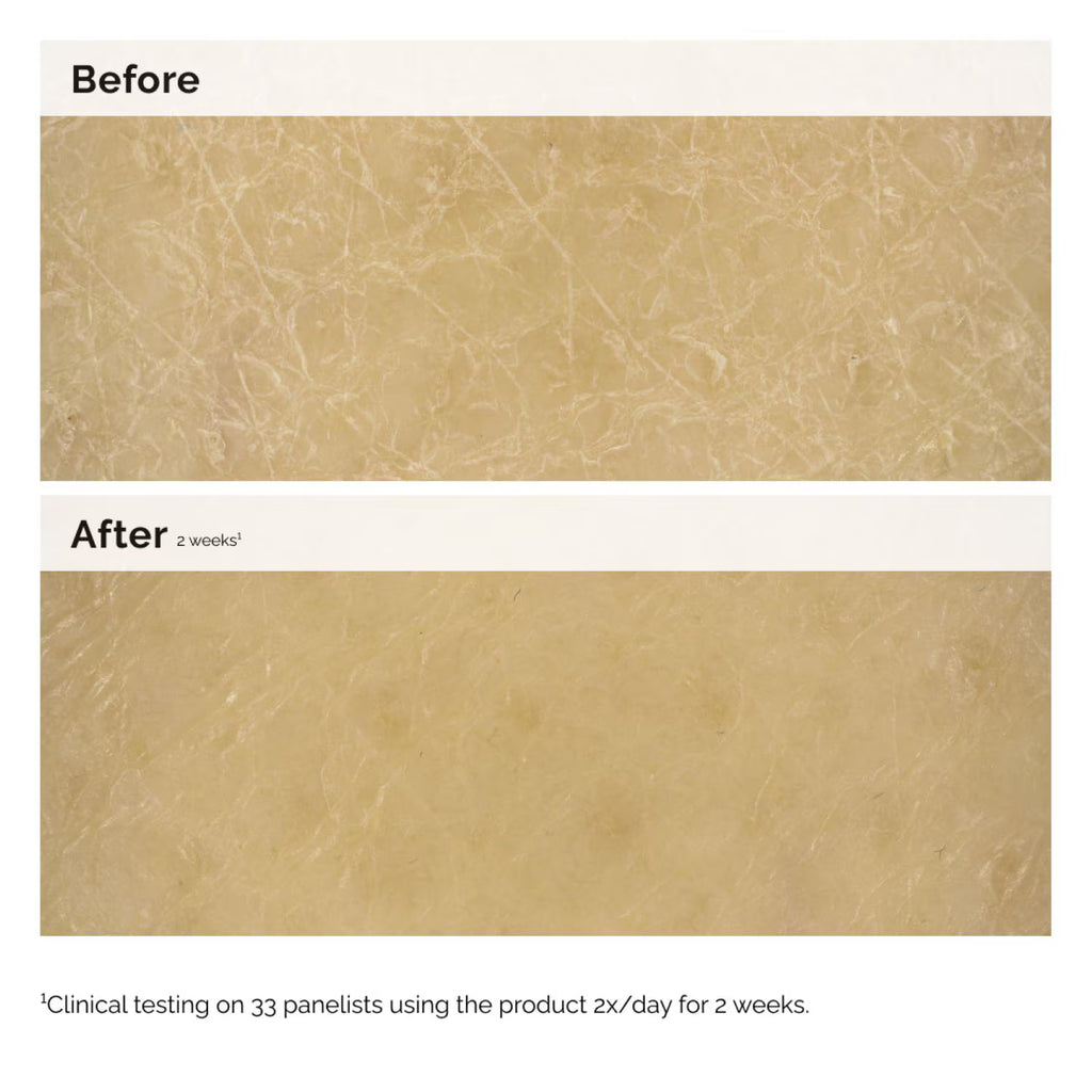 The Ordinary Natural Moisturizing Factors + Inulin