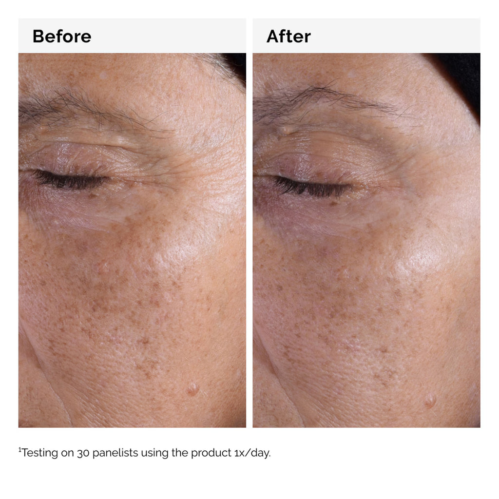 The Ordinary Glycolic Acid 7% - Piling Tonik