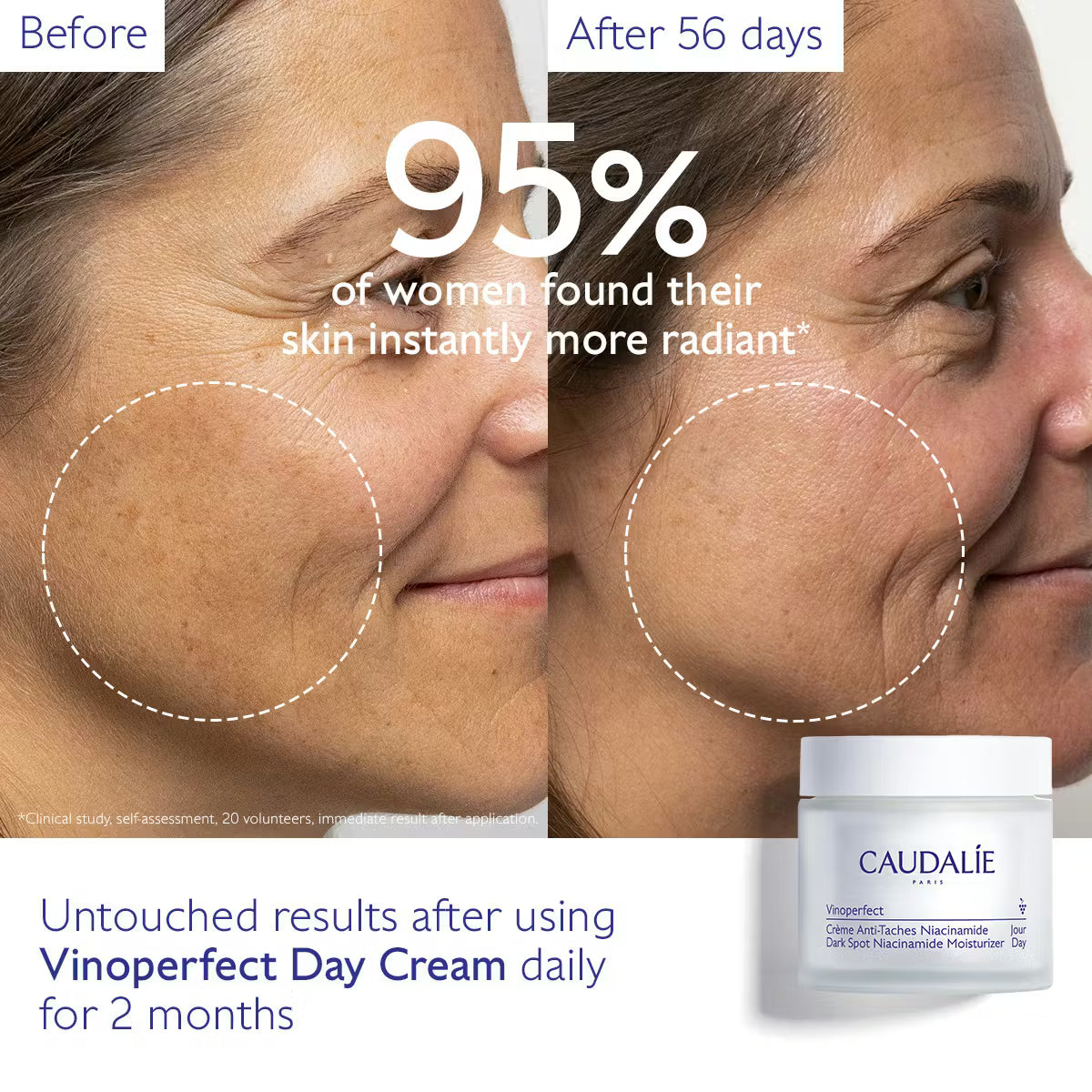 Caudalie Vinoperfect Anti-Pigmentflecken Radiance Cream