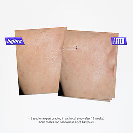 Kiehl’s Clearly Corrective Dark Spot Solution