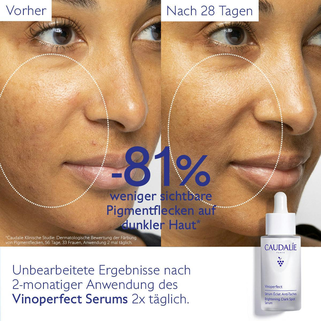 Caudalie Vinoperfect Radiance Dark Spot Serum