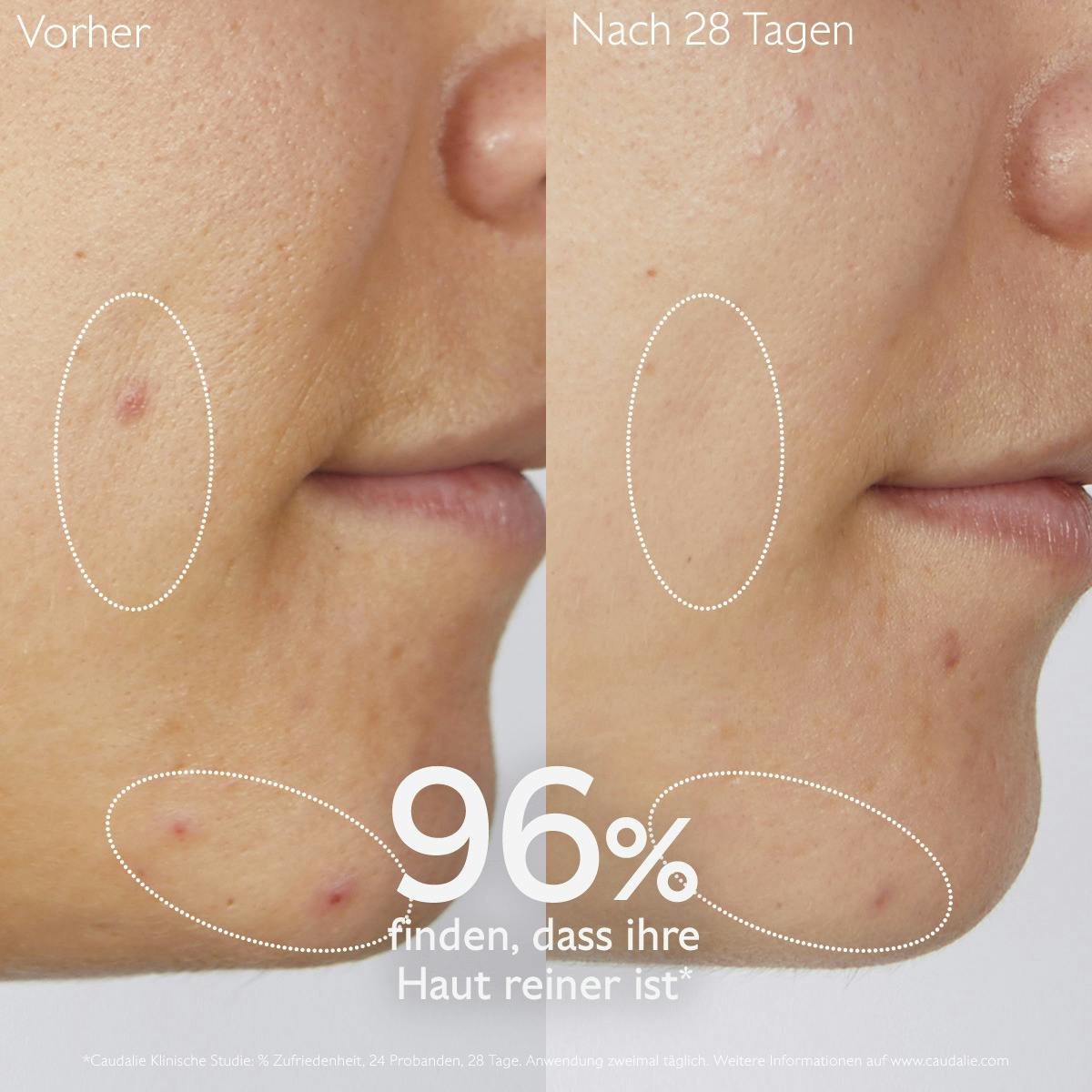 Caudalie Vinopure Purifying Gel Cleanser