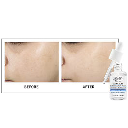 Kiehl’s Pure Serum 1.5% Hyaluronic Acid