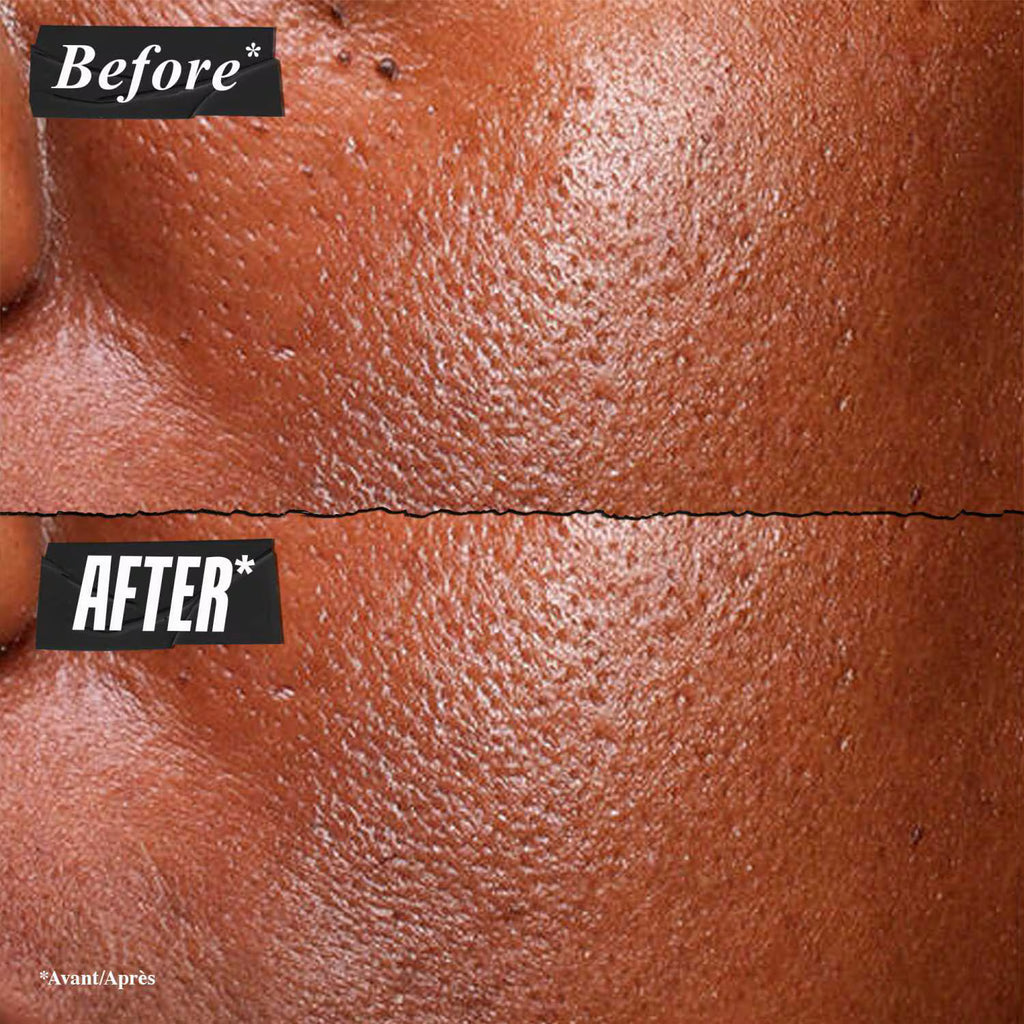 Kiehl’s Pure Serum 5% Niacinamide
