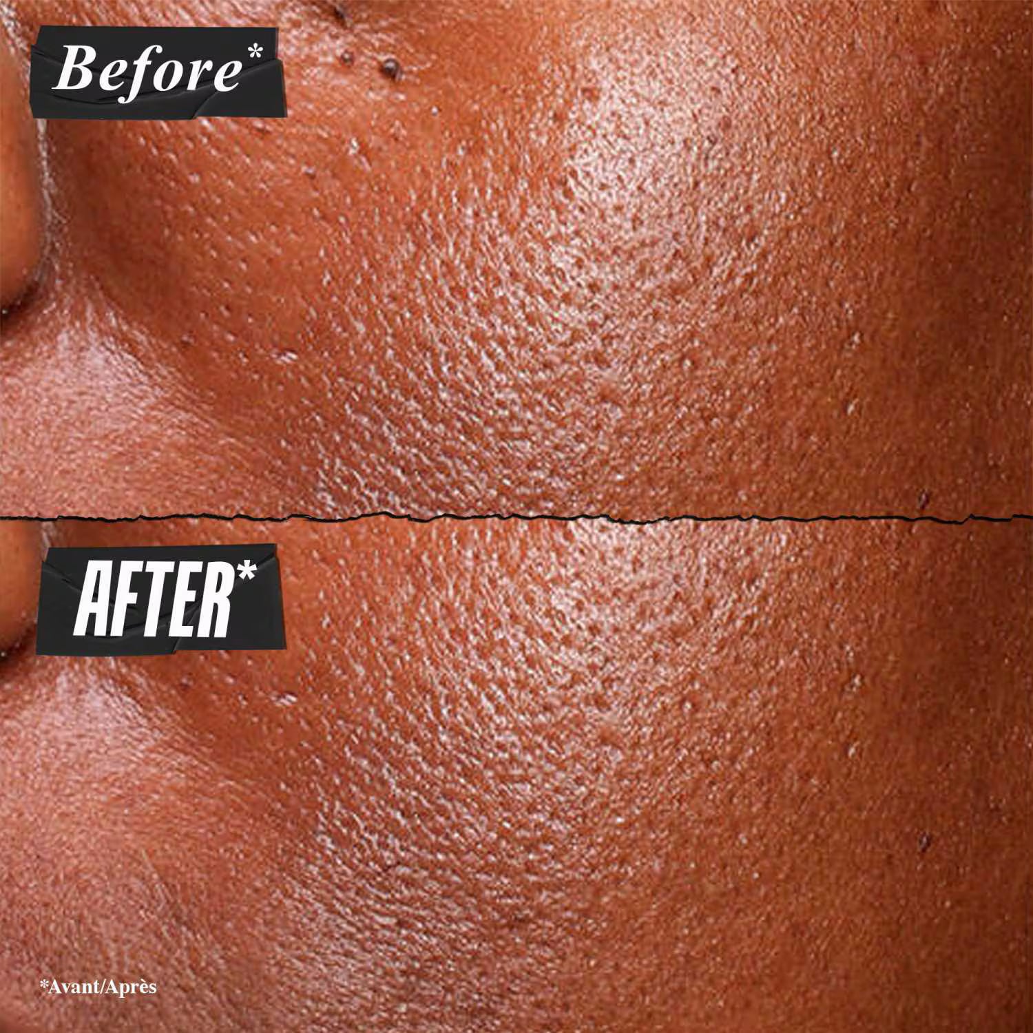 Kiehl’s Pure Serum 5% Niacinamide