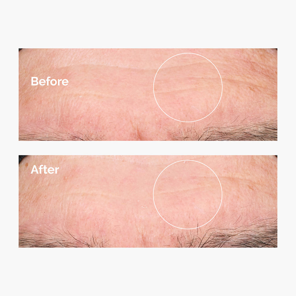 The Ordinary Hyaluronic Acid 2% + B5