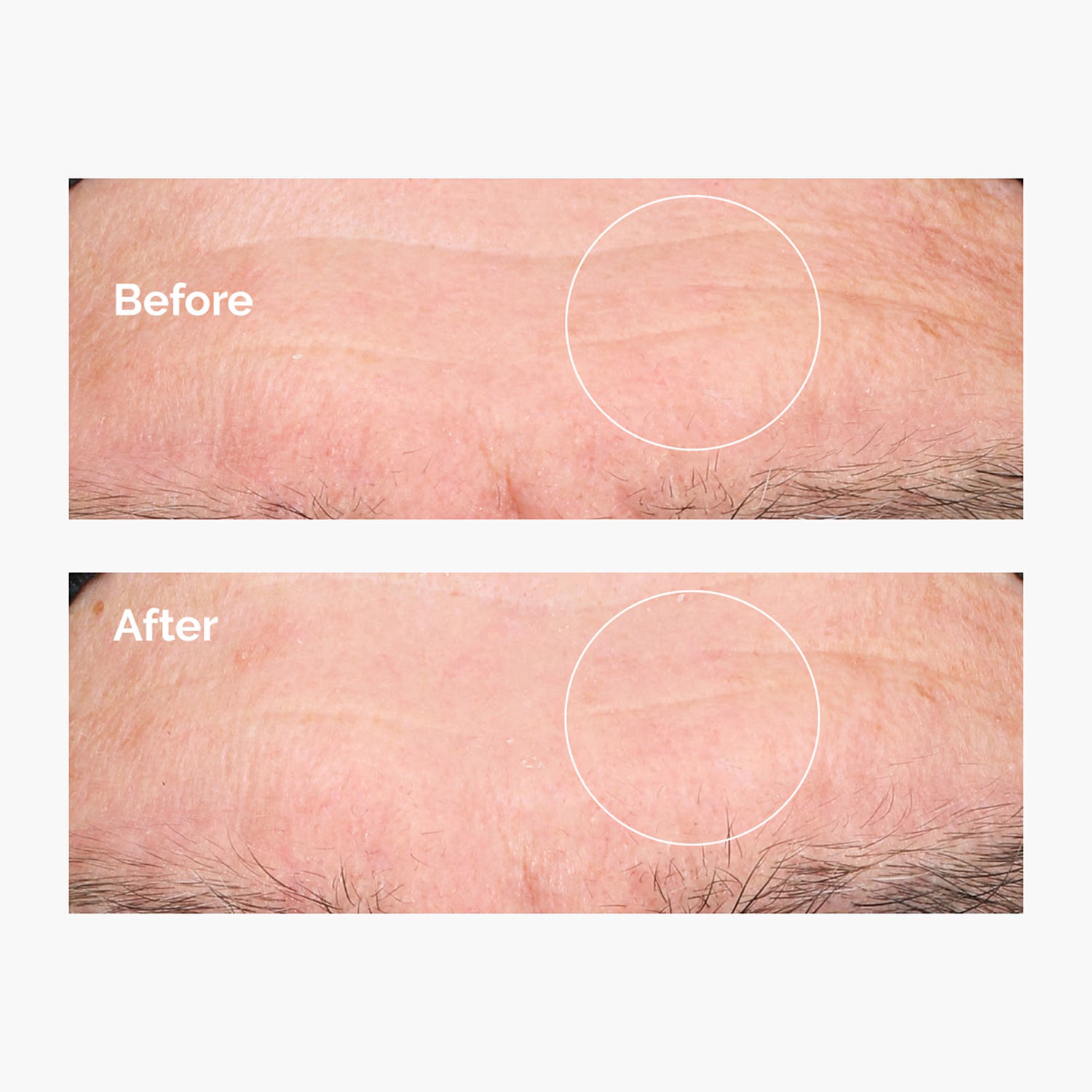 The Ordinary Hyaluronic Acid 2% + B5