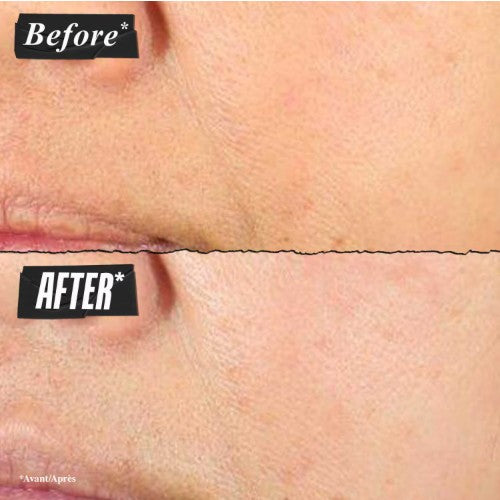 Kiehl’s Super Multi‑Corrective Cream