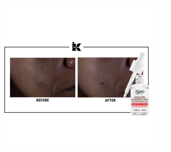 Kiehl’s Pure Serum Glycolic Acid 10%