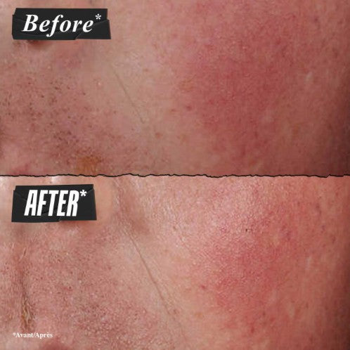 Kiehl’s Ultra Facial Advanced Repair Barrier Cream