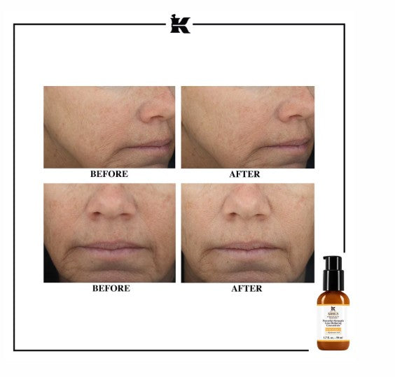 Kiehl’s Powerful Strength Line Reducing Concentrate