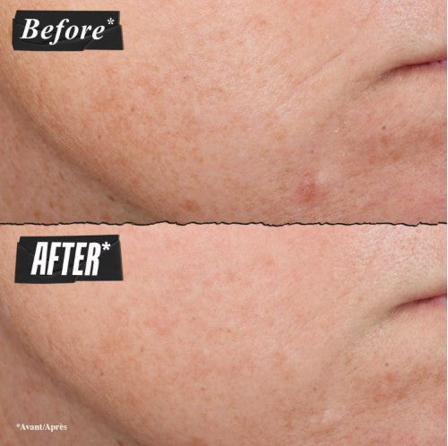 Kiehl’s Retinol Micro-Dose Treatment