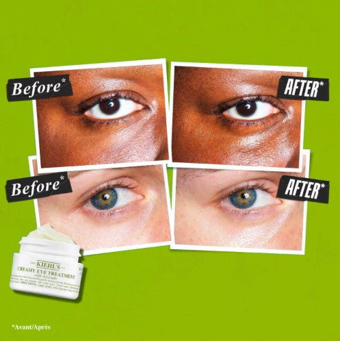 Kiehl’s Creamy Eye Treatment With Avocado