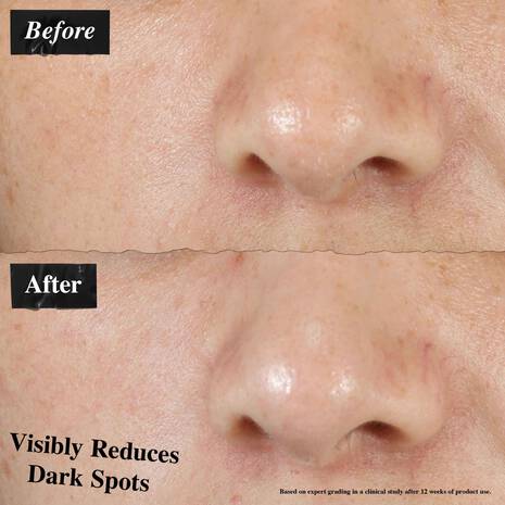 Kiehl’s Clearly Corrective Dark Spot Solution